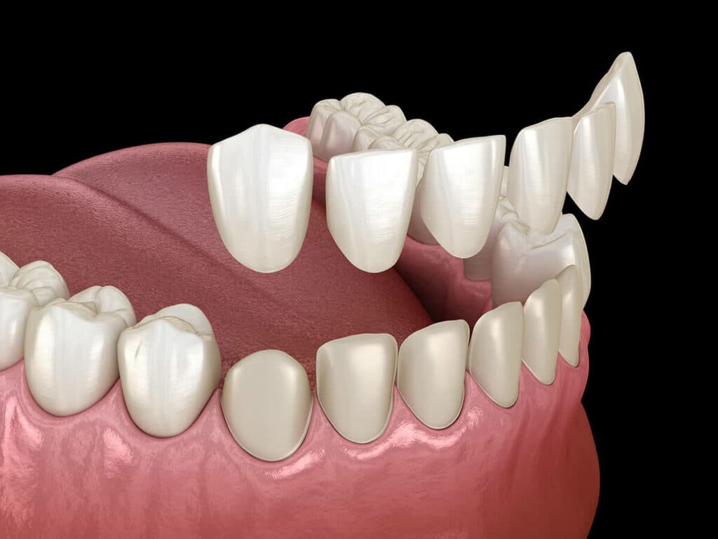 Cosmetic Dentistry