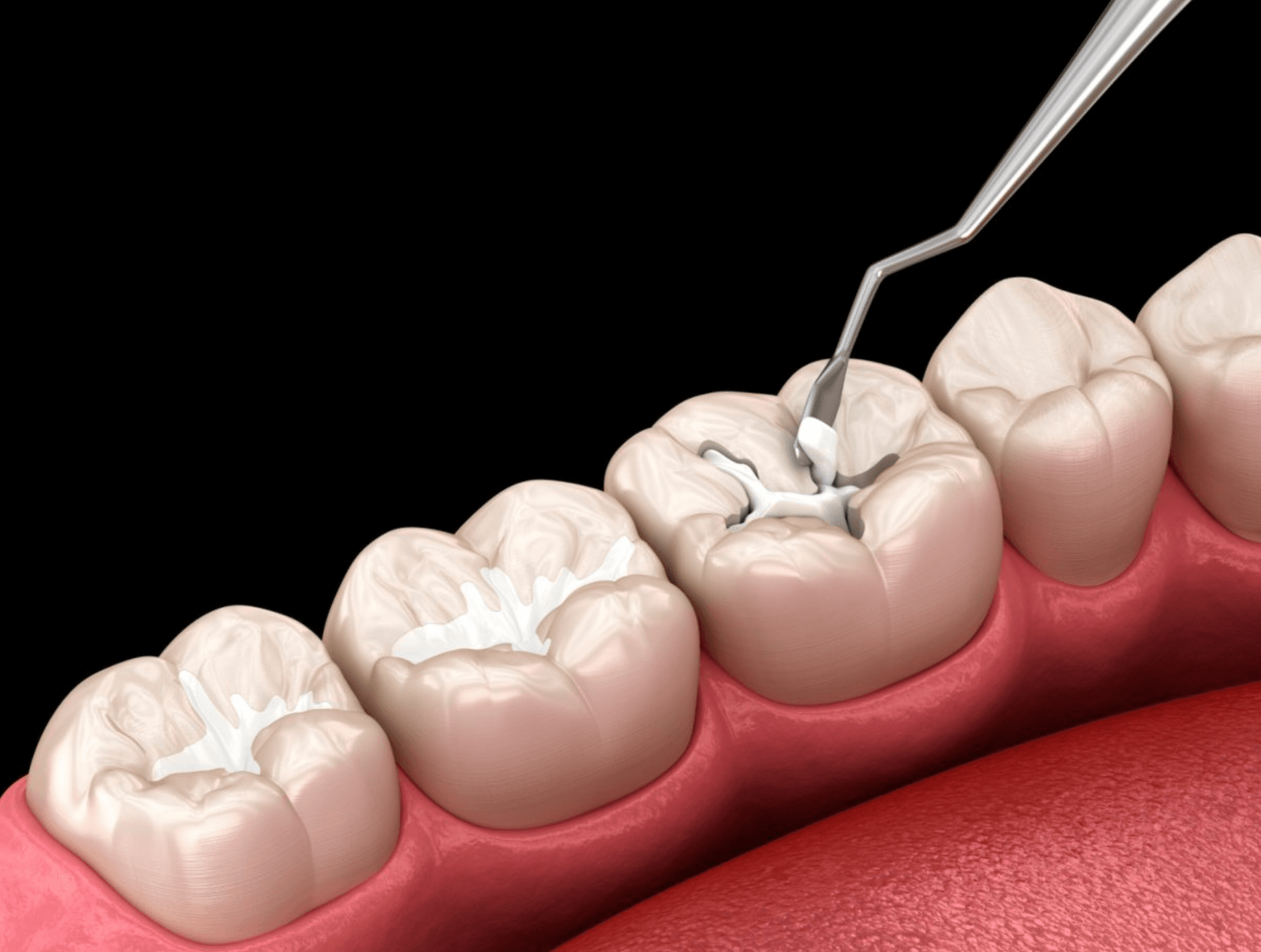 Preventive Dentistry