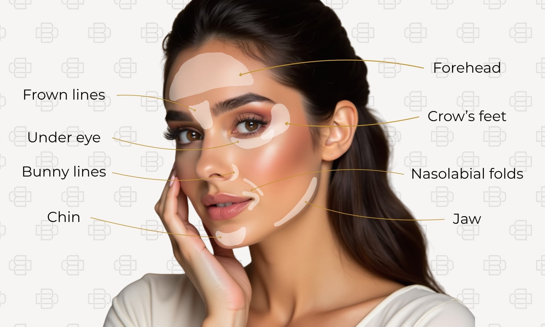 Botox treatment map showing facial injection areas for Dr. Marina Krasnopolsky's aesthetic treatments at Tribeca Dental Studio