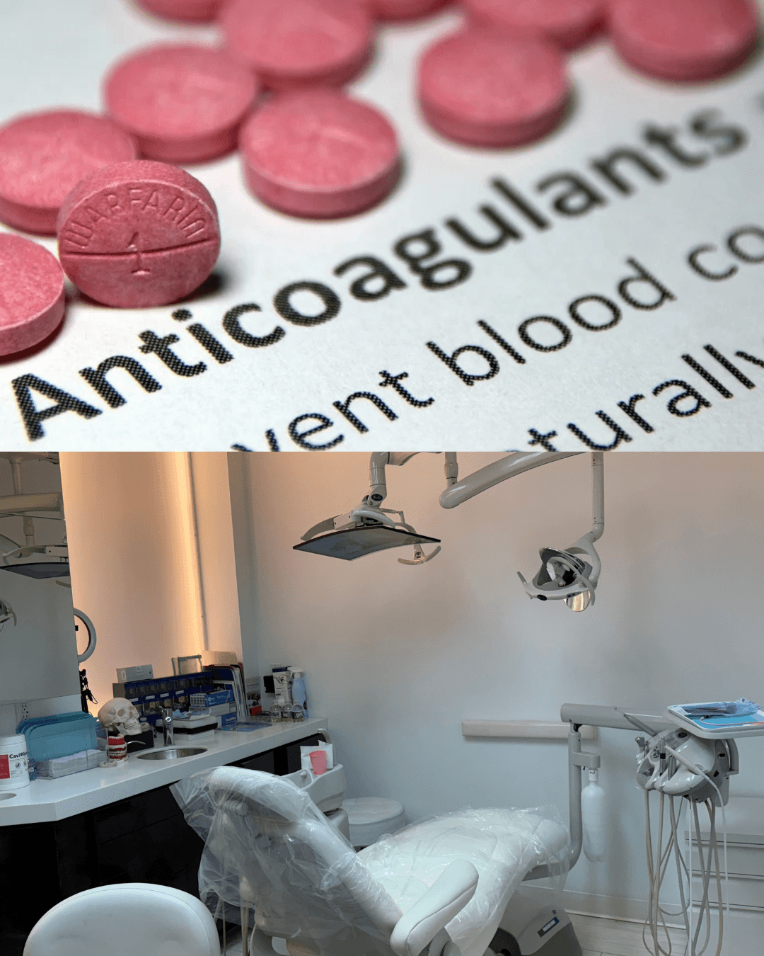 Dental Treatment on Anticoagulants: Safe Care for Blood Thinner Patients in Tribeca NYC