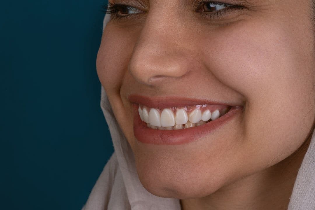 The Price of a Perfect Smile: What to Expect for Dental Implants